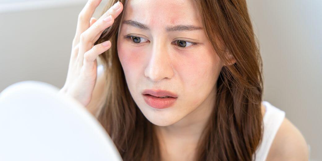 花粉や黄砂の影響でゆらぎやすい春の敏感肌イメージ