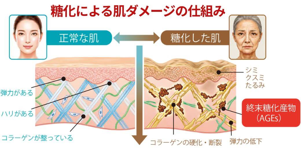 糖化による肌の変化を表現したイラスト