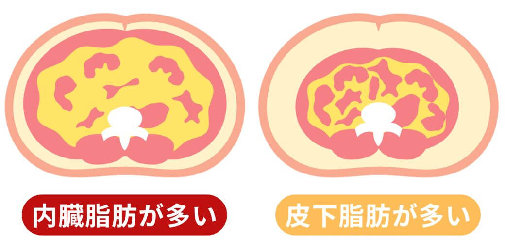 内臓脂肪と皮下脂肪の違い